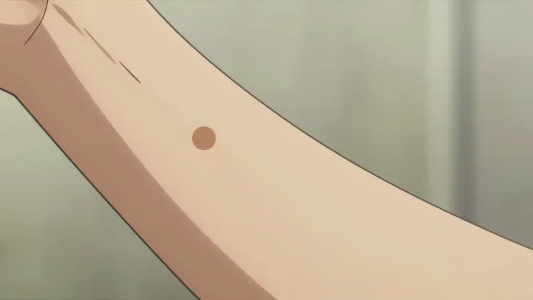 Visual representation of "lentigo" - A small, brown spot on the skin