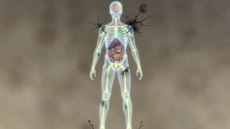 Visual representation of "systemic" - Affecting the whole body or system, not just a part of it