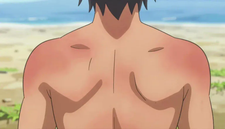 Visual representation of "erythema" - Erythema can also refer to a temporary skin condition, usually resulting from environmental factors such as sun exposure.