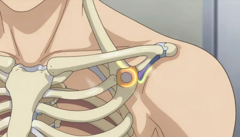 Visual representation of "sternoclavicular" - The sternoclavicular joint is the joint connecting the sternum and clavicle, allowing for movement of the shoulder.