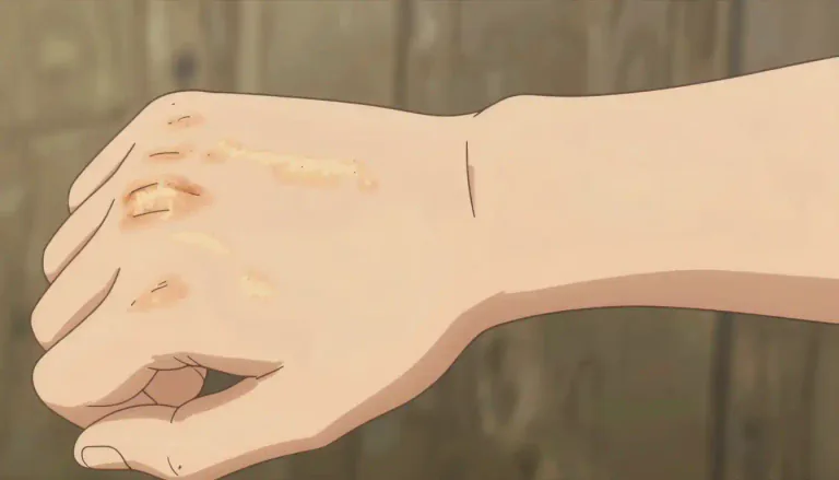 Visual representation of "cicatricial" - Relating to a scar or scarring resulting from healing after an injury.