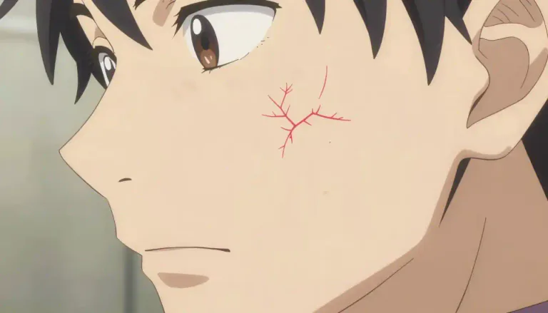 Visual representation of "telangiectasia" - Telangiectasia is a condition that causes small, dilated blood vessels to become visible on the surface of the skin.