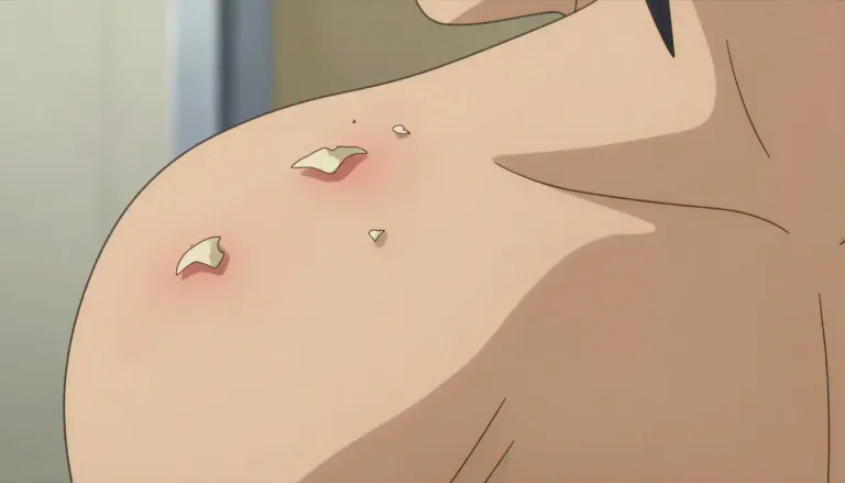 Visual representation of "pityriasis" - A skin condition that causes flaking or shedding of skin in patches.