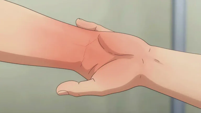 Visual representation of "erythema" - Erythema is a medical term that refers to the redness of the skin caused by increased blood flow in the capillaries.