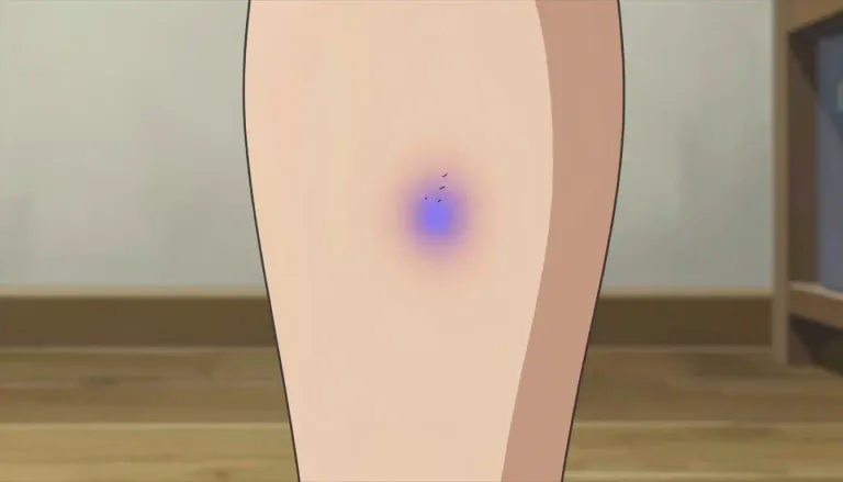 Visual representation of "bruise" - A mark on your skin caused by an injury