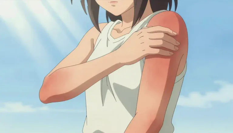 Visual representation of "photosensitivity" - A reaction in which a person's skin becomes inflamed or irritated due to exposure to light.