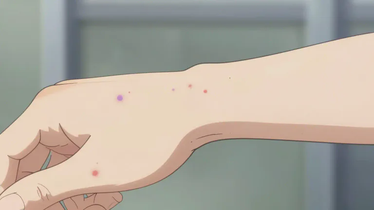 Visual representation of "purpura" - Purpura is a medical term that refers to a condition where small blood vessels leak blood under the skin, causing purple or red spots.