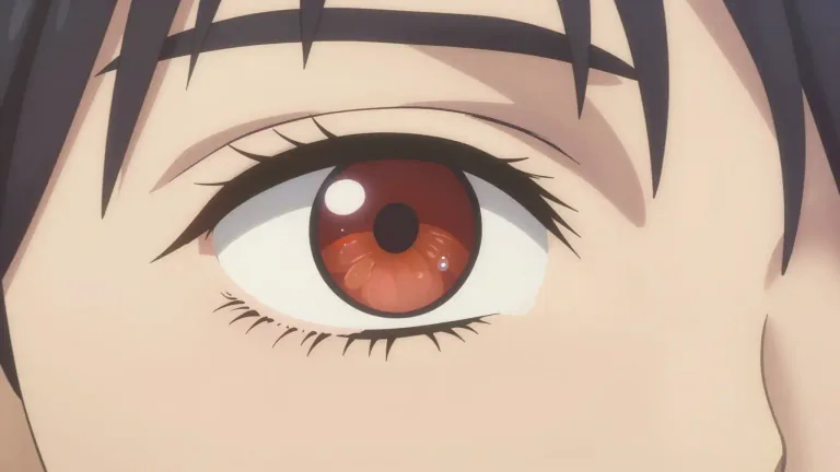 Visual representation of "iritis" - Iritis is an inflammation of the iris, the colored part of the eye, which can cause redness, pain, and vision issues.