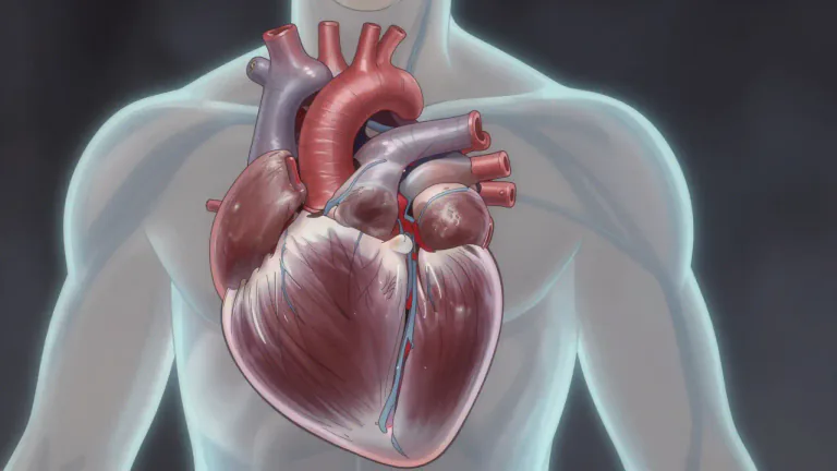 Visual representation of "cardiomyopathy" - A disease in which the heart muscle becomes enlarged, thick, or rigid, affecting its ability to pump blood effectively.