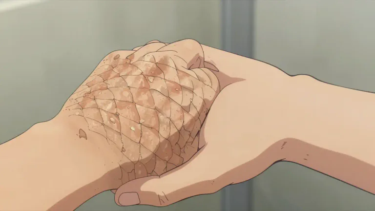 Visual representation of "ichthyosis" - A genetic skin disorder that causes the skin to become excessively dry and scaly.