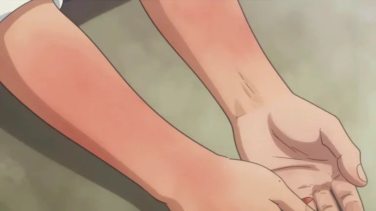 Visual representation of "erythematous" - Pertaining to or characterized by erythema, which is redness of the skin caused by an increase in blood flow.
