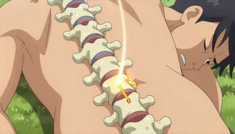 Visual representation of "herniated" - Describes a condition where an organ or tissue protrudes through a weak spot in the surrounding muscle or connective tissue.