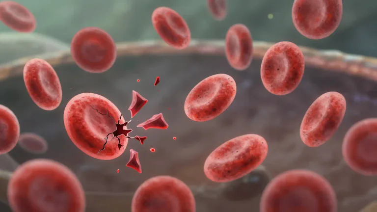 Visual representation of "haemolytic" - Relating to the destruction of red blood cells.