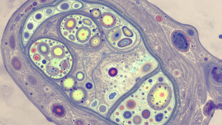Visual representation of "mosaic" - A condition in genetics where an individual has cells of different genetic makeup.
